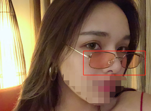 隆鼻,极受欢迎的整形项目