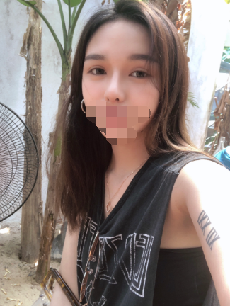 隆鼻,极受欢迎的整形项目
