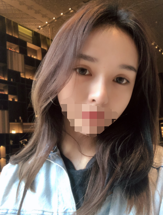 隆鼻,极受欢迎的整形项目