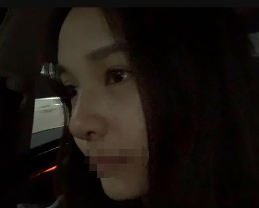 隆鼻,极受欢迎的整形项目