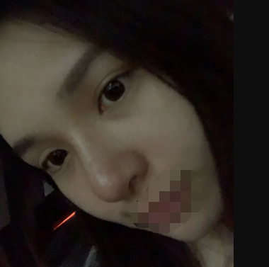 隆鼻,极受欢迎的整形项目