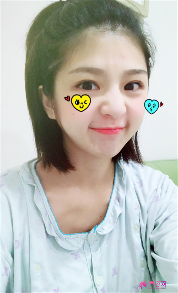 我做的双眼皮你们看的出来吗?姐妹们都说看不出来我的痕迹啊~嘿嘿~进来我给你们分享我较近变美的照片吧!