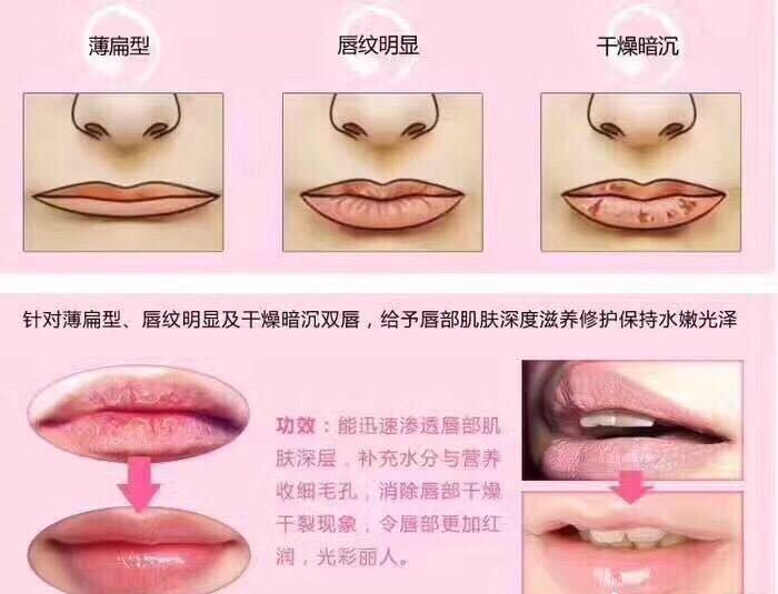 唇部小知识,什么是唇纹?