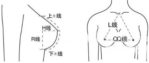 隆胸怎么选择适合自己的假体材料?