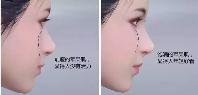 饱满的苹果肌,即使年过三十照样装嫩