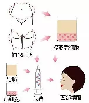 饱满的苹果肌,即使年过三十照样装嫩