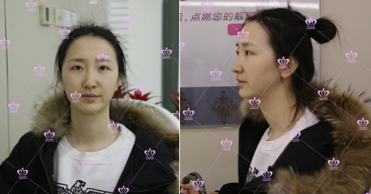 饱满的苹果肌,即使年过三十照样装嫩