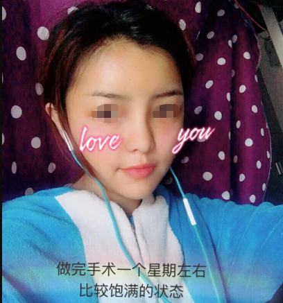 “纳米脂肪”究竟是什么?能用来干什么?