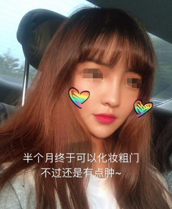 “纳米脂肪”究竟是什么?能用来干什么?