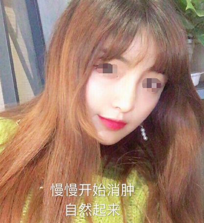 “纳米脂肪”究竟是什么?能用来干什么?