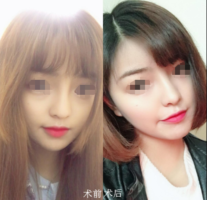 “纳米脂肪”究竟是什么?能用来干什么?