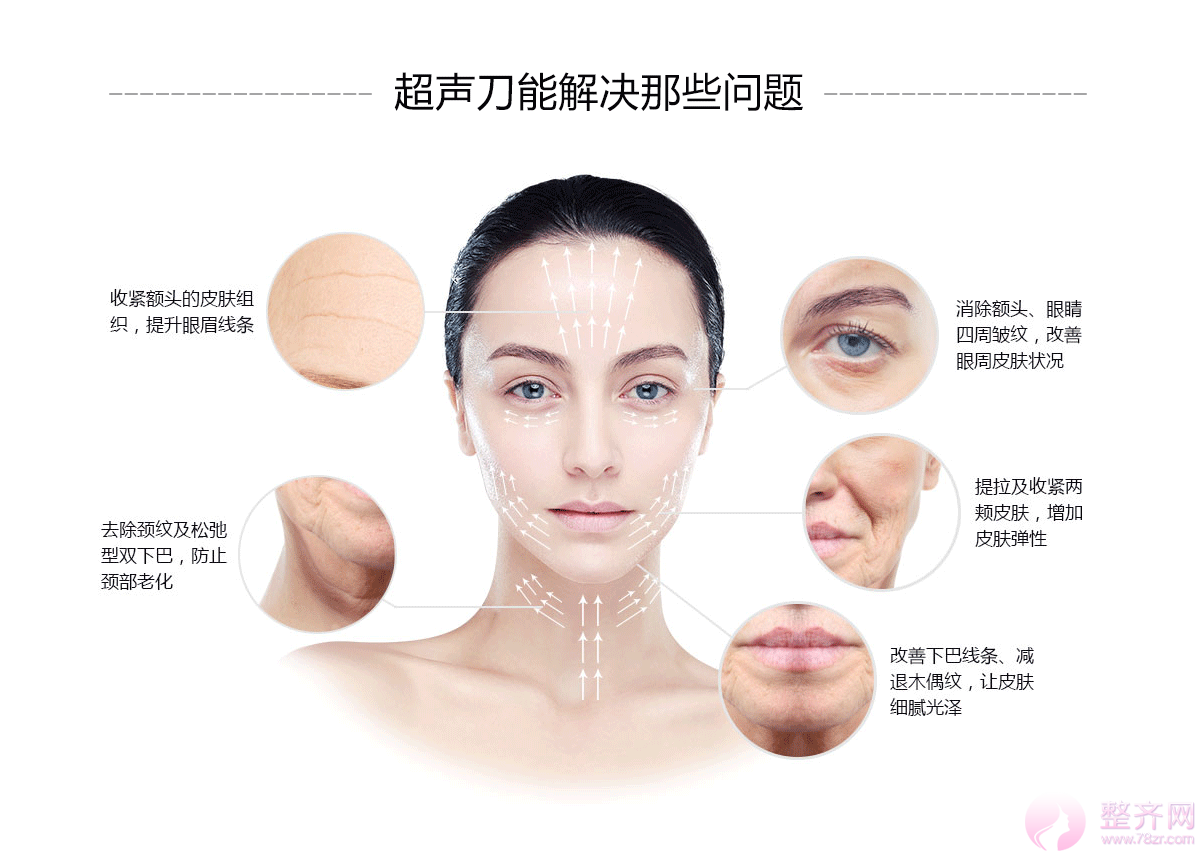 超声提拉在紧致抗衰方面有哪些优势?