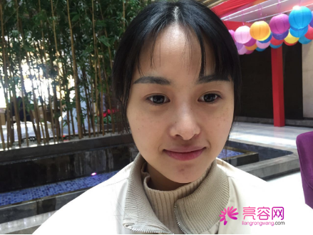 时间过得真快,说着说着5月都过了大半了,我做了埋线提升提升一个月案例分享,做一个漂亮全新的自己。