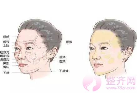 自体脂肪填充面部的五大误区,你都知道吗?