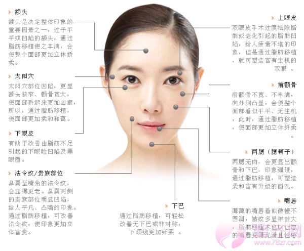 自体脂肪填充面部的五大误区,你都知道吗?