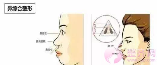 鼻部手术, 到底能有多美?