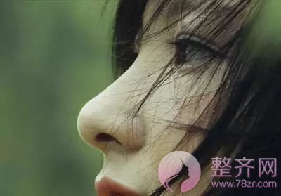 单纯隆鼻or鼻部手术,应该怎么选择?