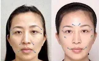 颧骨高不想磨骨,如何解决?这个攻略送给你