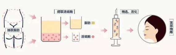 颧骨高不想磨骨,如何解决?这个攻略送给你