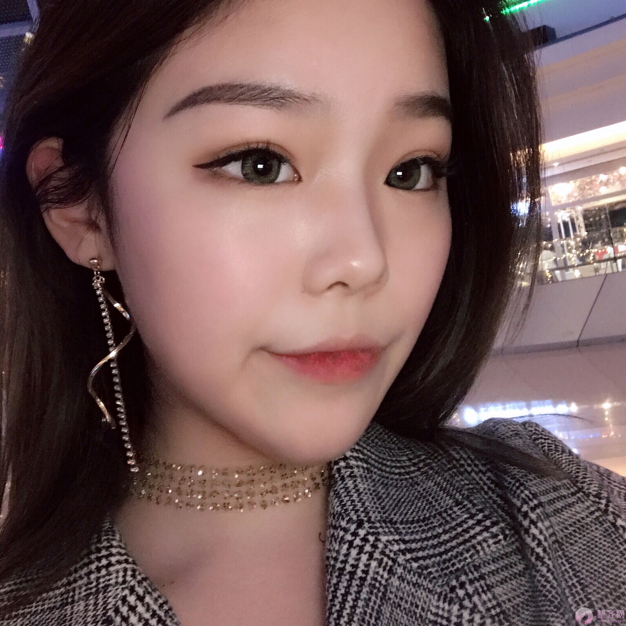 为什么那么多人热衷于下颌角手术?