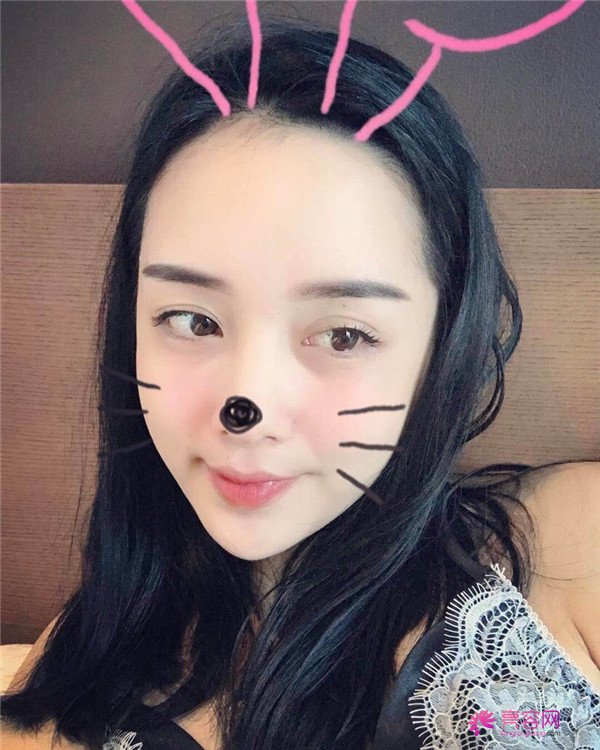 小仙女儿们,我也要过六一啦!!~~快快进来看我的神奇变美经历!脸部轮廓美的不行啊~~拍照再也不用各种找角度了嘻嘻~~,虽然都是成年人了~~不行不行~我也要过六一~~