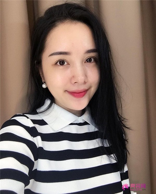 小仙女儿们,我也要过六一啦!!~~快快进来看我的神奇变美经历!脸部轮廓美的不行啊~~拍照再也不用各种找角度了嘻嘻~~,虽然都是成年人了~~不行不行~我也要过六一~~