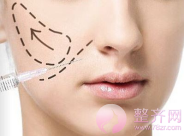苹果肌干瘪,没有笑容力量?