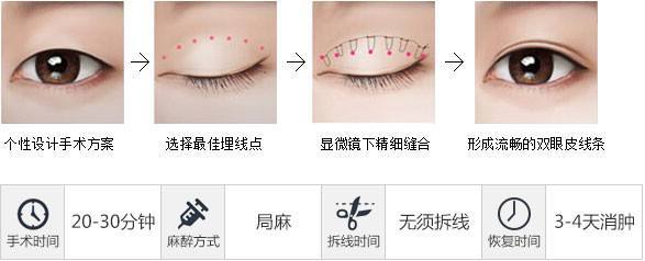 为什么她割了双眼皮却没人知道呢?