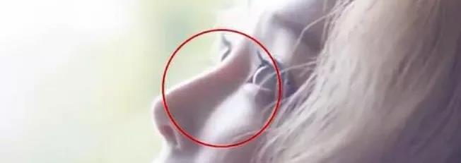 花大价钱隆鼻却成歪鼻,紧急求助……