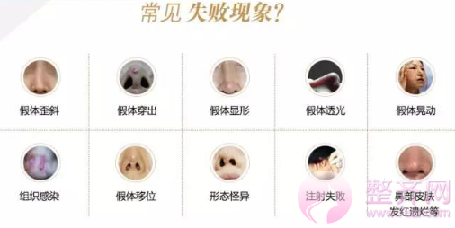 你的鼻整形失败了还有救吗?