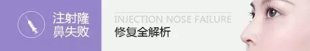你的鼻整形失败了还有救吗?
