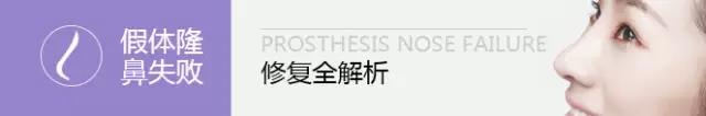 你的鼻整形失败了还有救吗?