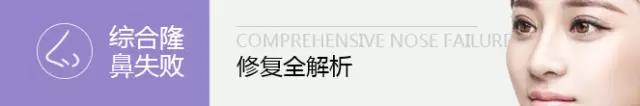 你的鼻整形失败了还有救吗?
