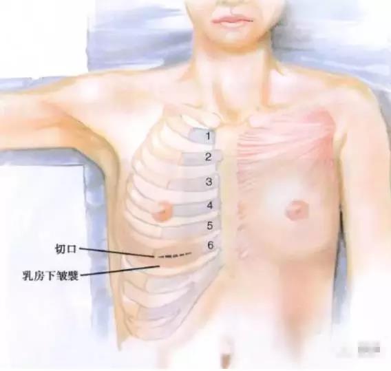 关于自体肋软骨隆鼻,它到底有多可怕?