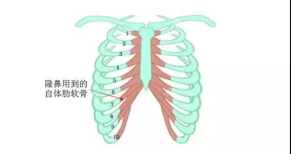 关于自体肋软骨隆鼻,它到底有多可怕?