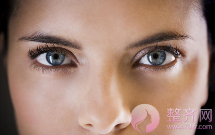 为什么欧式双眼皮不适合你?