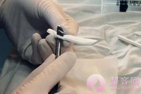 进行假体隆鼻术后,鼻尖为何发红?