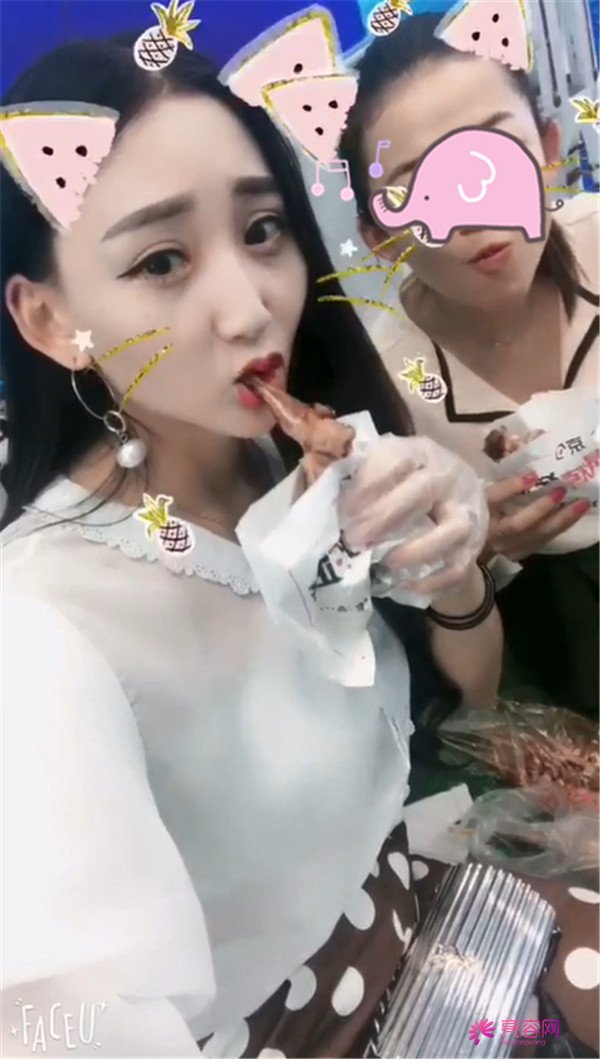 【全切双眼皮四个月案例分享】哈喽宝宝们,进来看看我是怎么从小眼睛单眼皮逆袭成大眼女神的