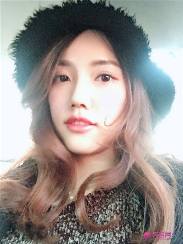 仙女们,拥有一个高而挺的鼻子是我很向往的,做了鼻部手术,我也有高而挺的鼻子啦~~~~