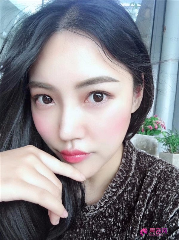 仙女们,拥有一个高而挺的鼻子是我很向往的,做了鼻部手术,我也有高而挺的鼻子啦~~~~