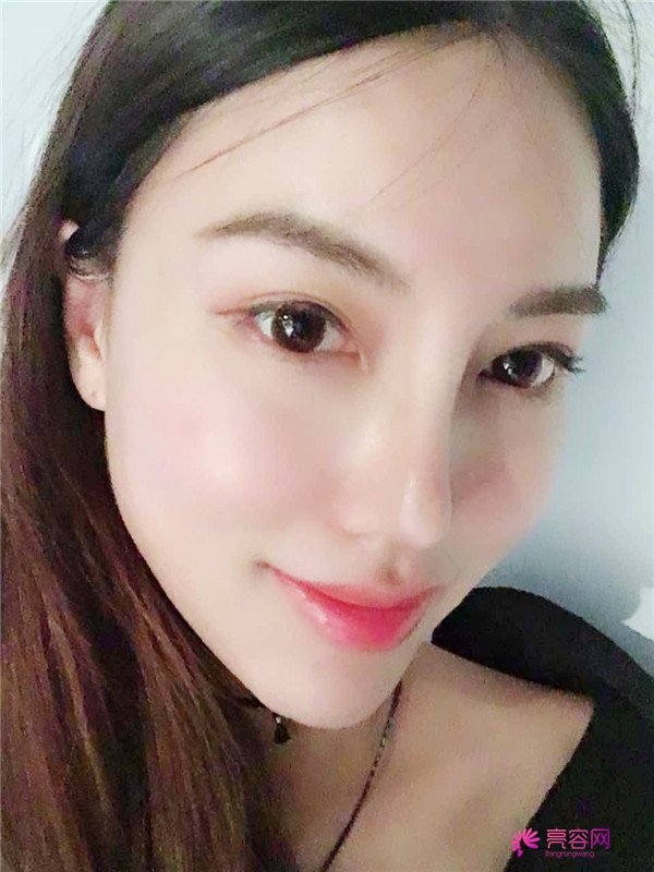仙女们,拥有一个高而挺的鼻子是我很向往的,做了鼻部手术,我也有高而挺的鼻子啦~~~~