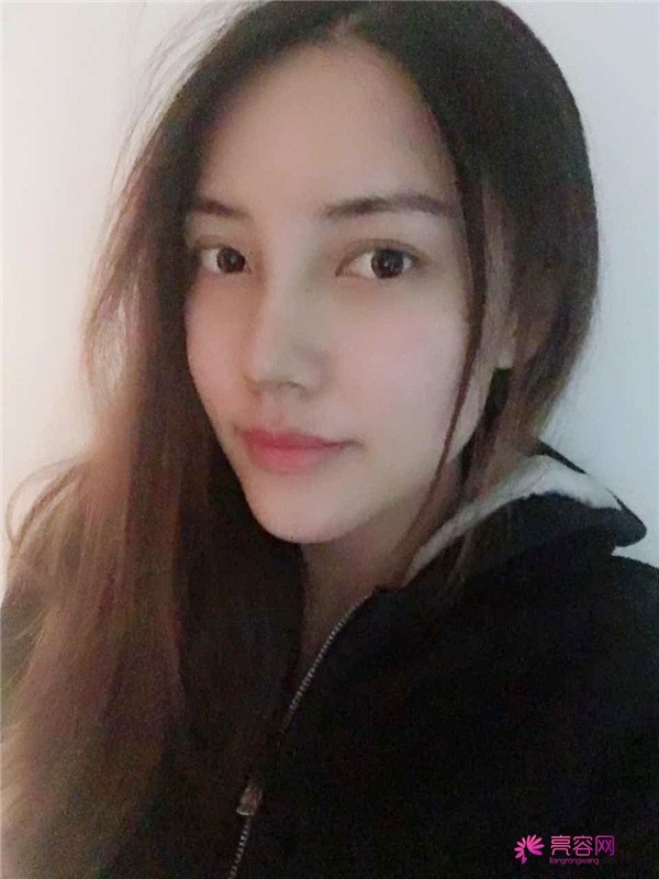 仙女们,拥有一个高而挺的鼻子是我很向往的,做了鼻部手术,我也有高而挺的鼻子啦~~~~