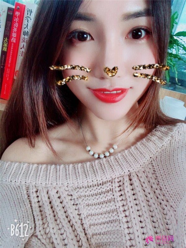 仙女们,拥有一个高而挺的鼻子是我很向往的,做了鼻部手术,我也有高而挺的鼻子啦~~~~
