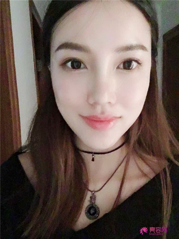 仙女们,拥有一个高而挺的鼻子是我很向往的,做了鼻部手术,我也有高而挺的鼻子啦~~~~