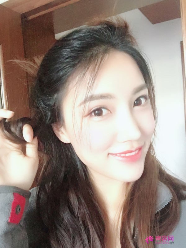 仙女们,拥有一个高而挺的鼻子是我很向往的,做了鼻部手术,我也有高而挺的鼻子啦~~~~