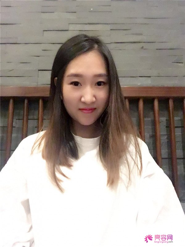 你们羡慕我的巴掌脸吗?真的只有巴掌大哦!哈哈宝宝们来看看我的案例吧,我只打了注射瘦脸哦