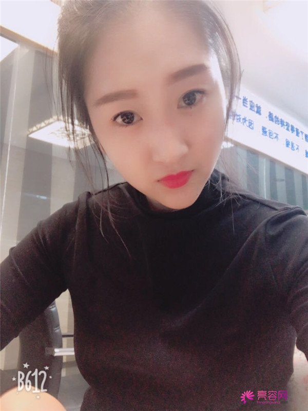 你们羡慕我的巴掌脸吗?真的只有巴掌大哦!哈哈宝宝们来看看我的案例吧,我只打了注射瘦脸哦