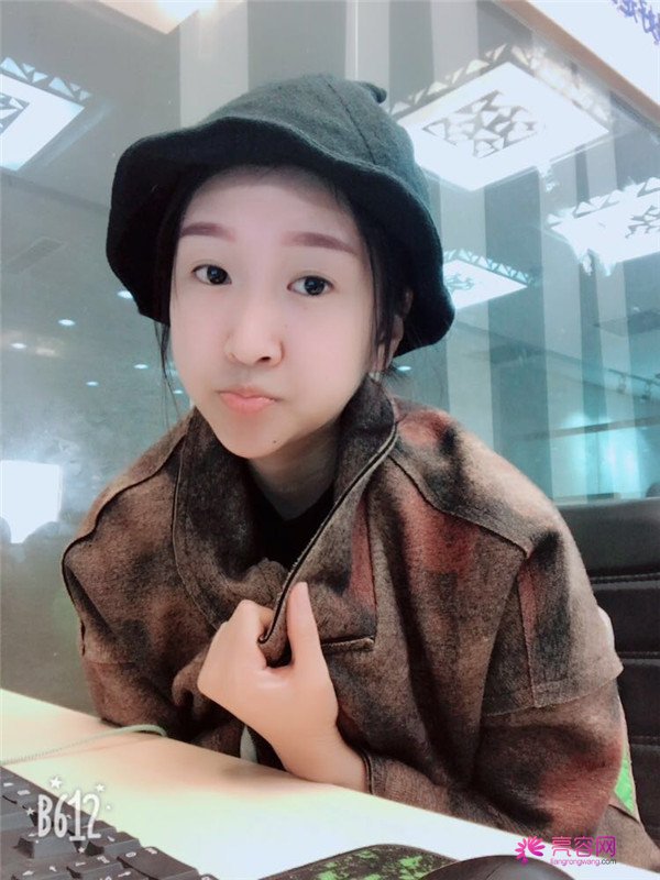 你们羡慕我的巴掌脸吗?真的只有巴掌大哦!哈哈宝宝们来看看我的案例吧,我只打了注射瘦脸哦