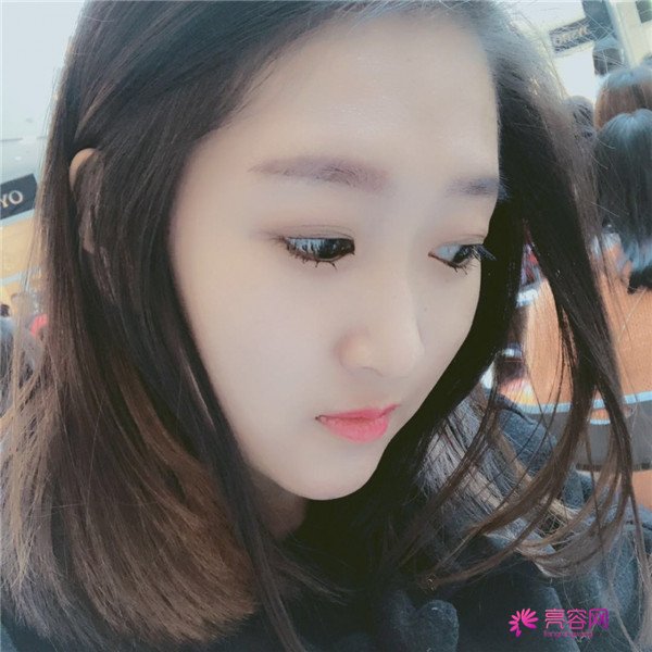 你们羡慕我的巴掌脸吗?真的只有巴掌大哦!哈哈宝宝们来看看我的案例吧,我只打了注射瘦脸哦