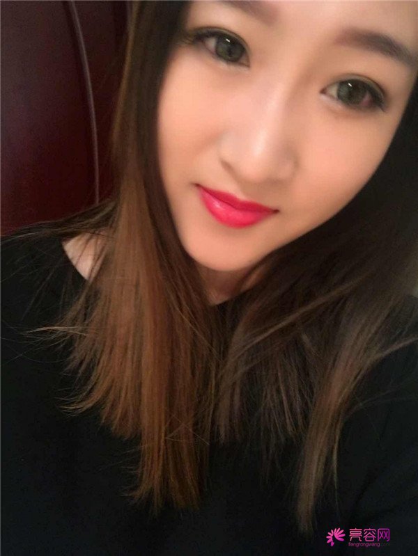 你们羡慕我的巴掌脸吗?真的只有巴掌大哦!哈哈宝宝们来看看我的案例吧,我只打了注射瘦脸哦